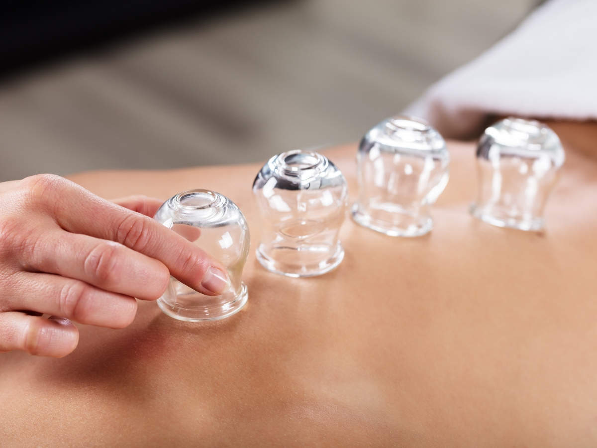 Cupping Treatments For Weight Loss: Get One Today!